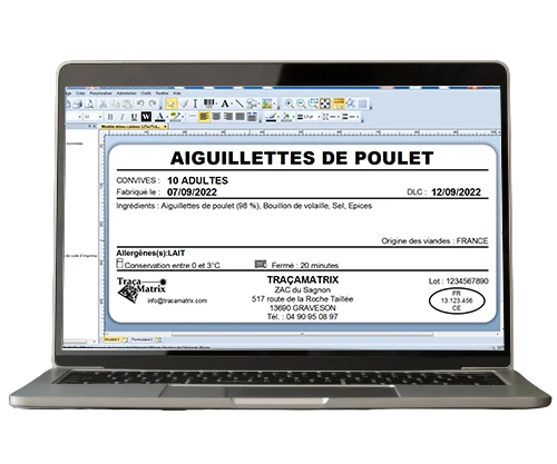 Aplex Interface Recette